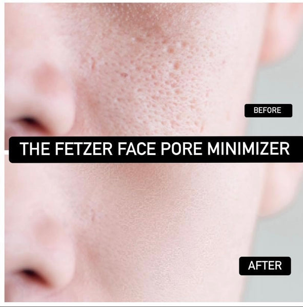 Fetzer Face Pore Minimizer